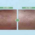 【2025年最新版】ディレクターパイさん厳選！オイリー肌におすすめのトナー5選♡